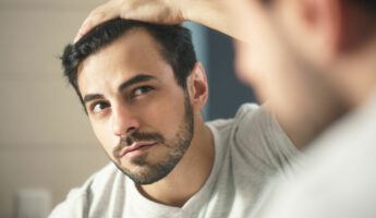 Mature Hairline Causes and Cures