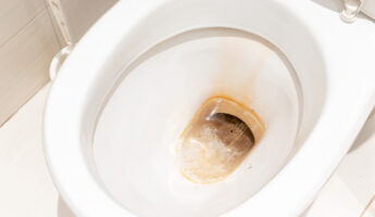Spraying vinegar around the toilet: what it’s for and why it’s recommended