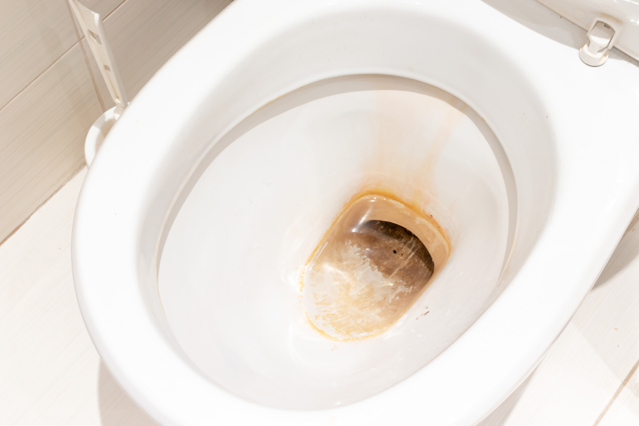 Spraying vinegar around the toilet: what it’s for and why it’s recommended